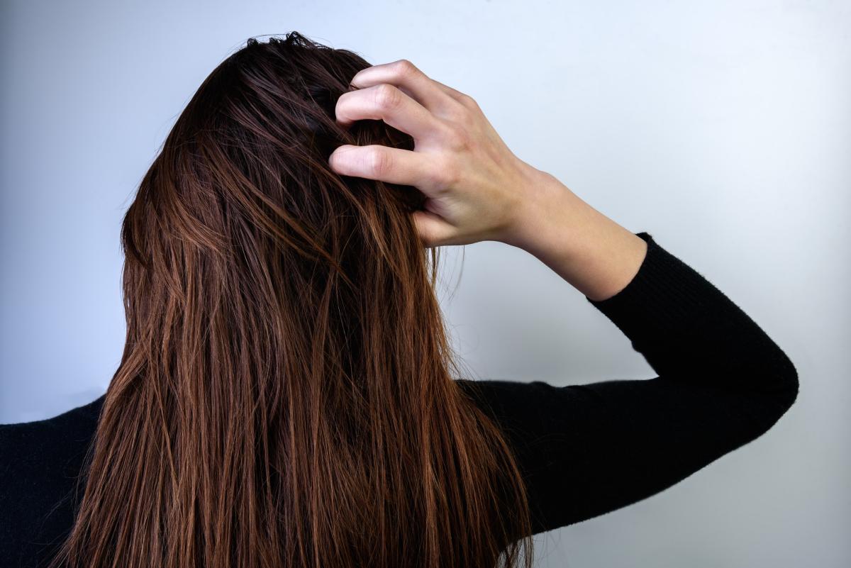 Twoje włosy mają tendencję do przetłuszczania się? Wiemy, jak temu zaradzić