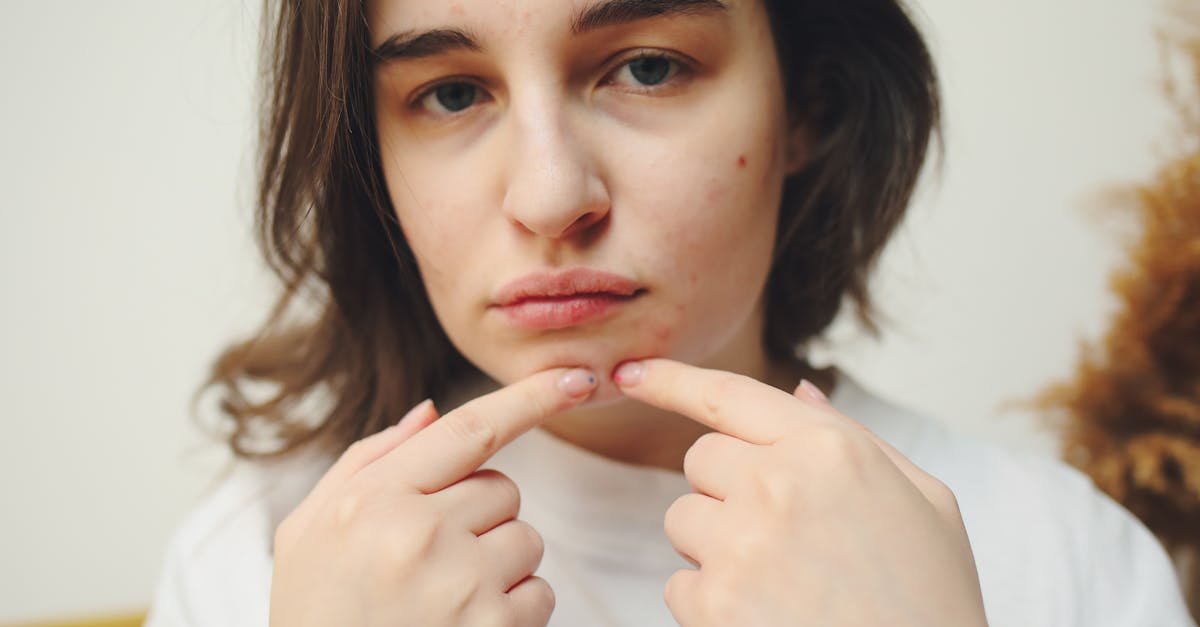 Przyczyny trądziku na twarzy – mapa twarz: co oznaczają zmiany i jak je interpretować