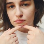 Przyczyny trądziku na twarzy – mapa twarz: co oznaczają zmiany i jak je interpretować